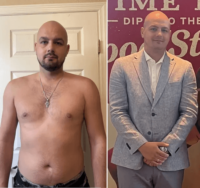 Mark before and after